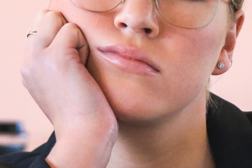 A person resting their jaw on their palm. They are frowning.